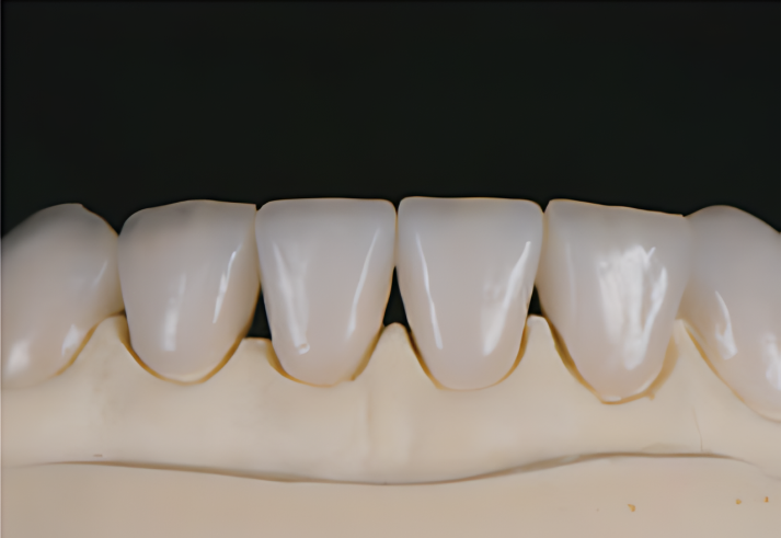 Cameo - Dental Glass Ceramic -400Mpa Aidite
