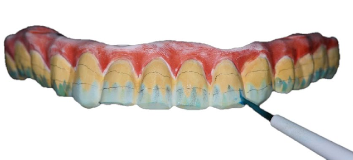 Incisal Color Liquid Aidite