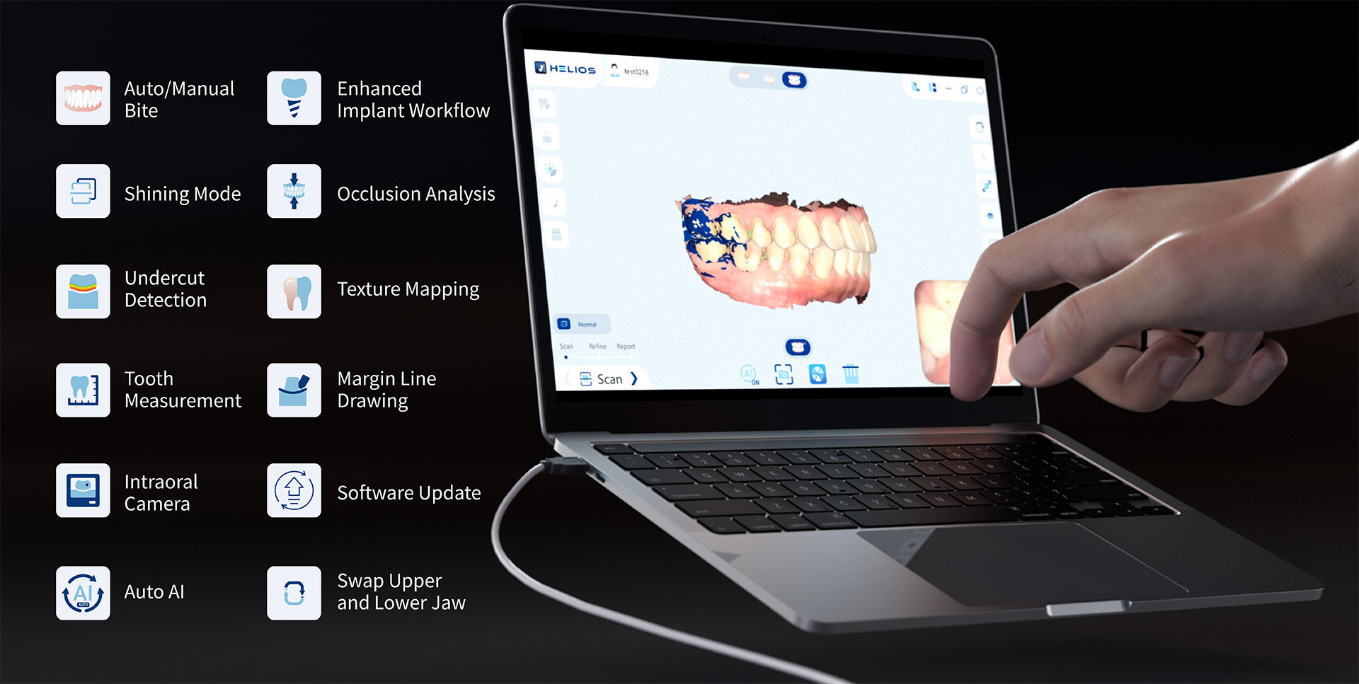 Helios 680 - Intraoral Scanner Wired Eighteeth