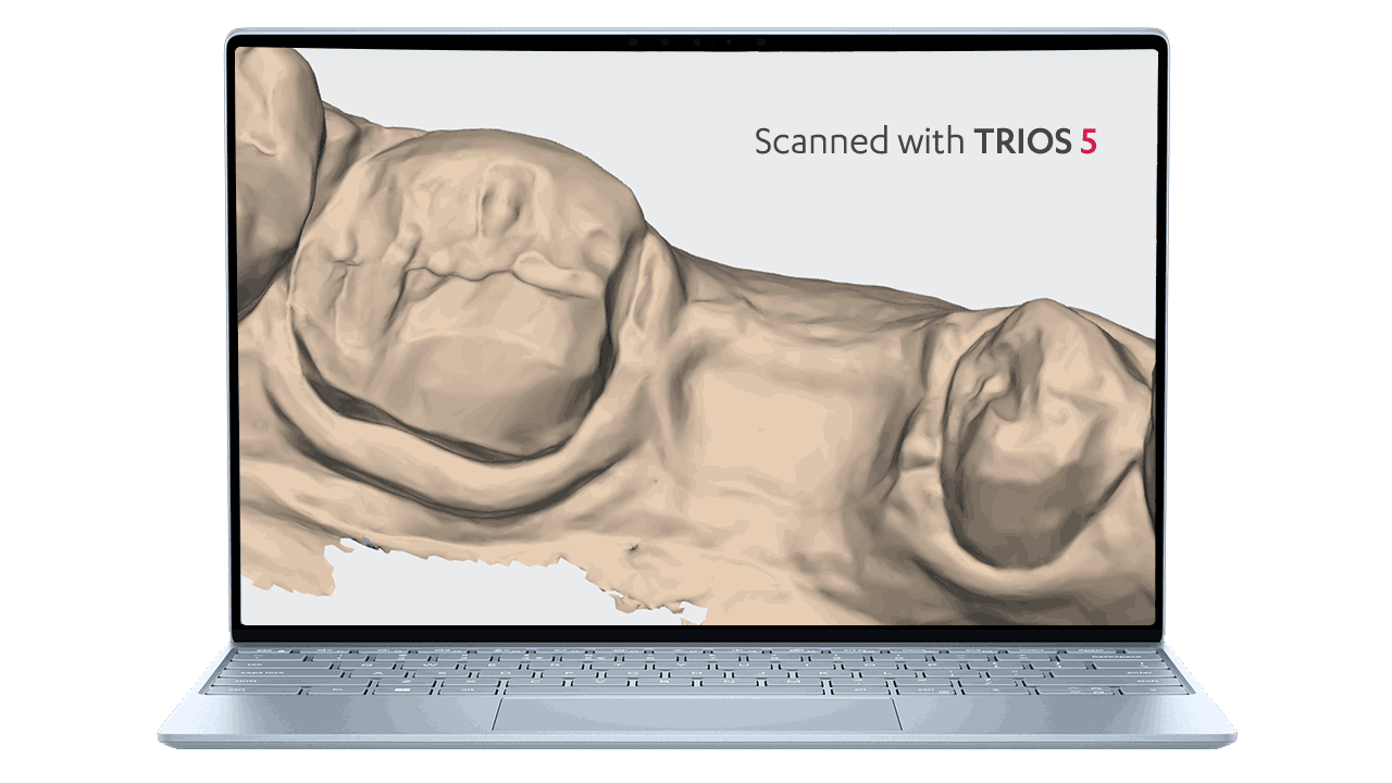 Trios 6 Wireless - Intraoral Scanner* Coming Soon 3 Shape
